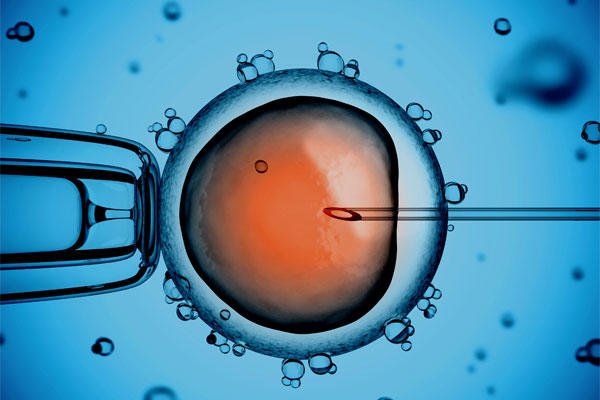 In Vitro Fertilization – IVF