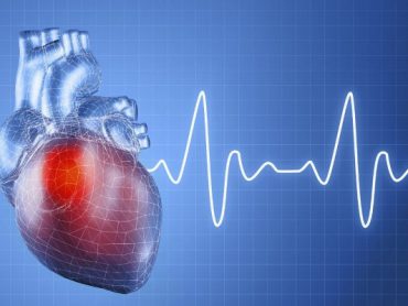 Intervetional Cardiology