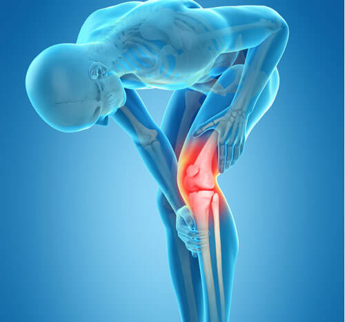 Knee Replacement Surgery Best Medical Care Service Medical Arrow Medical Tourism Experts